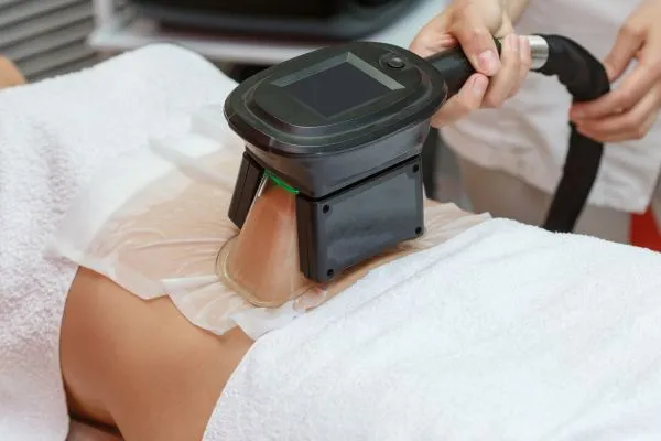 Image of person having fat freezing treatment to help weight gain Kensington and Chelsea