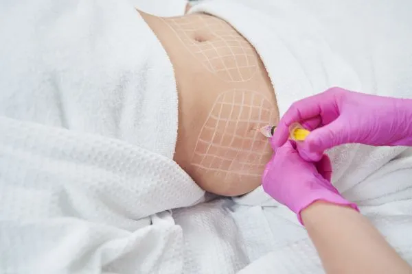 image of fat dissolving injections on love handles to help combat weight gain Kensington and Chelsea