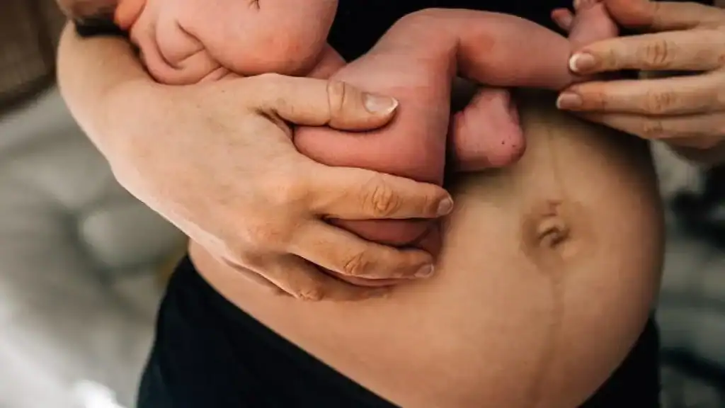 Why Is My Stomach Still Big After Pregnancy Kensington and Chelsea?